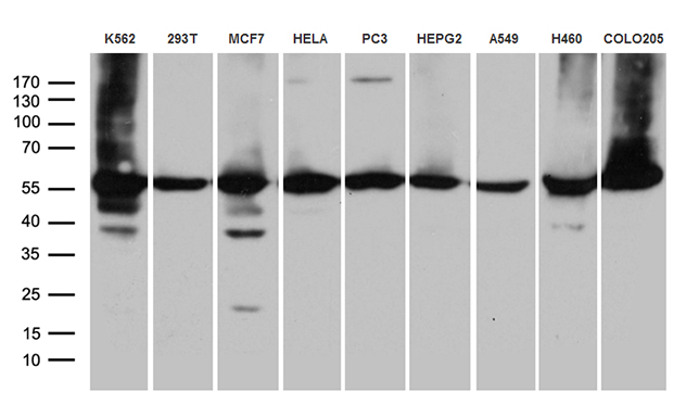 CCT4 / SRB Antibody - Western blot analysis of extracts. (35ug) from 9 cell lines by using anti-CCT4 monoclonal antibody. (1:500)