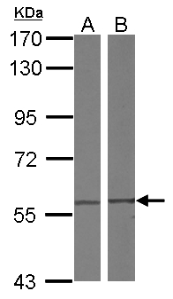 CCT4 / SRB Antibody - Sample (30 ug of whole cell lysate) A: A431 B: Raji 7.5% SDS PAGE CCT4 antibody diluted at 1:1000