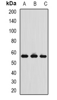 CCT4 / SRB Antibody - Western blot analysis of TCP1-delta expression in MCF7 (A); THP1 (B); mouse spleen (C) whole cell lysates.