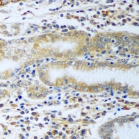 CCT4 / SRB Antibody - Immunohistochemical analysis of TCP1-delta staining in rat stomach formalin fixed paraffin embedded tissue section. The section was pre-treated using heat mediated antigen retrieval with sodium citrate buffer (pH 6.0). The section was then incubated with the antibody at room temperature and detected using an HRP conjugated compact polymer system. DAB was used as the chromogen. The section was then counterstained with hematoxylin and mounted with DPX.