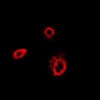 CCT4 / SRB Antibody - Immunofluorescent analysis of TCP1-delta staining in HeLa cells. Formalin-fixed cells were permeabilized with 0.1% Triton X-100 in TBS for 5-10 minutes and blocked with 3% BSA-PBS for 30 minutes at room temperature. Cells were probed with the primary antibody in 3% BSA-PBS and incubated overnight at 4 deg C in a humidified chamber. Cells were washed with PBST and incubated with a DyLight 594-conjugated secondary antibody (red) in PBS at room temperature in the dark.