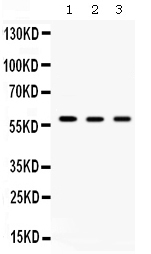 CCT4 / SRB Antibody - Western blot - Anti-TCP1 delta Picoband Antibody