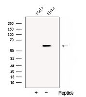 CCT4 / SRB Antibody - Western blot analysis of extracts of HeLa cells using CCT4 antibody. The lane on the left was treated with blocking peptide.