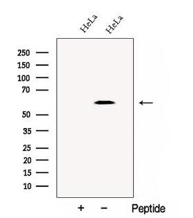 CCT4 / SRB Antibody - Western blot analysis of extracts of HeLa cells using CCT4 antibody. The lane on the left was treated with blocking peptide.