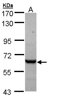 CCT5 / TCP1 Epsilon Antibody - Sample (30 ug of whole cell lysate). A: A431 . 7.5% SDS PAGE. CCT5 / TCP1 Epsilon antibody diluted at 1:1000