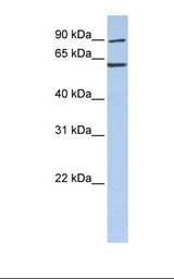 CCT5 / TCP1 Epsilon Antibody - Fetal brain lysate. Antibody concentration: 1.0 ug/ml. Gel concentration: 12%.  This image was taken for the unconjugated form of this product. Other forms have not been tested.