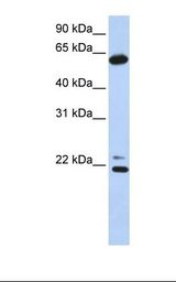 CCT5 / TCP1 Epsilon Antibody - 293T cell lysate. Antibody concentration: 1.0 ug/ml. Gel concentration: 12%.  This image was taken for the unconjugated form of this product. Other forms have not been tested.