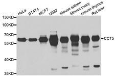 CCT5 / TCP1 Epsilon Antibody - Western blot analysis of extracts of various cell lines.