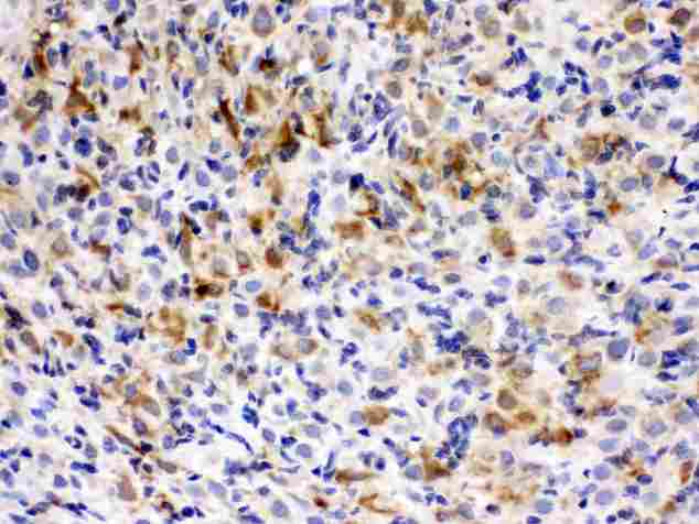 CCT5 / TCP1 Epsilon Antibody - TCP1 epsilon was detected in paraffin-embedded sections of rat ovary tissues using rabbit anti- TCP1 epsilon Antigen Affinity purified polyclonal antibody