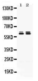 CCT5 / TCP1 Epsilon Antibody - Western blot analysis of CCT5 using anti-CCT5 antibody. Electrophoresis was performed on a 5-20% SDS-PAGE gel at 70V (Stacking gel) / 90V (Resolving gel) for 2-3 hours. The sample well of each lane was loaded with 50ug of sample under reducing conditions. Lane 1: rat testis tissue lysates, Lane 2: HELA whole cell lysates. After Electrophoresis, proteins were transferred to a Nitrocellulose membrane at 150mA for 50-90 minutes. Blocked the membrane with 5% Non-fat Milk/ TBS for 1.5 hour at RT. The membrane was incubated with rabbit anti-CCT5 antigen affinity purified polyclonal antibody at 0.5 µg/mL overnight at 4°C, then washed with TBS-0.1% Tween 3 times with 5 minutes each and probed with a goat anti-rabbit IgG-HRP secondary antibody at a dilution of 1:10000 for 1.5 hour at RT. The signal is developed using an Enhanced Chemiluminescent detection (ECL) kit with Tanon 5200 system. A specific band was detected for CCT5 at approximately 60KD. The expected band size for CCT5 is at 60KD.