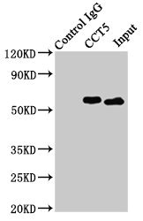 CCT5 / TCP1 Epsilon Antibody - Immunoprecipitating CCT5 in Hela whole cell lysate Lane 1: Rabbit control IgG (1µg) instead of product in Hela whole cell lysate.For western blotting,a HRP-conjugated Protein G antibody was used as the Secondary antibody (1/2000) Lane 2: product (8µg) + Hela whole cell lysate (500µg) Lane 3: Hela whole cell lysate (10µg)