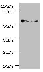 CCT5 / TCP1 Epsilon Antibody - Western blot All Lanes:CCT5 antibody at 1.78ug/ml Lane 1:Hela whole cell lysate Lane 2:Colo320 whole cell lysate Secondary Goat polyclonal to rabbit at 1/10000 dilution Predicted band size: 60,50 kDa Observed band size: 60 kDa