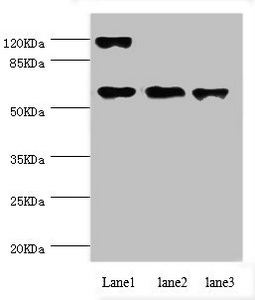 CCT5 / TCP1 Epsilon Antibody - Western blot All Lanes:CCT5 antibody at 1.84ug/ml Lane 1:Hela whole cell lysate Lane 2:Colo320 whole cell lysate Lane 3:mouse ovarian tissue Secondary Goat polyclonal to rabbit at 1/10000 dilution Predicted band size: 60,50 kDa Observed band size: 60 kDa