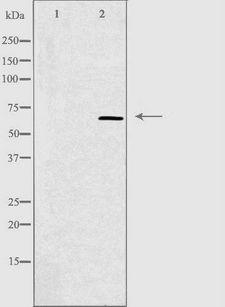 CCT5 / TCP1 Epsilon Antibody - Western blot analysis of extracts of HepG2 cells using CCT5 antibody. The lane on the left is treated with the antigen-specific peptide.