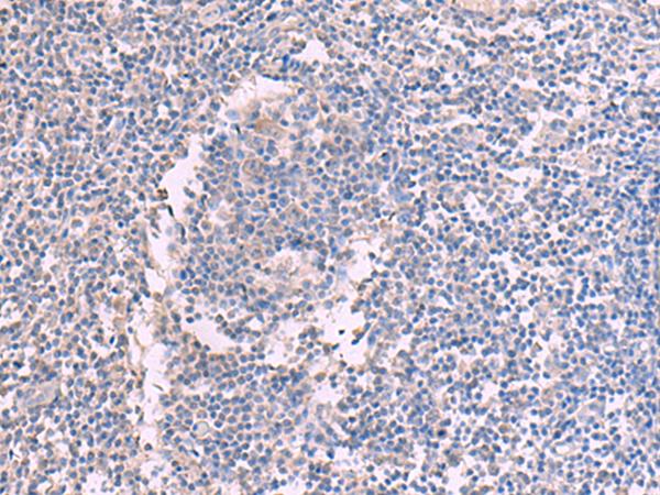 CCT5 / TCP1 Epsilon Antibody - Immunohistochemistry of paraffin-embedded Human tonsil tissue  using CCT5 Polyclonal Antibody at dilution of 1:60(×200)