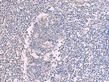 CCT5 / TCP1 Epsilon Antibody - Immunohistochemistry of paraffin-embedded Human tonsil tissue  using CCT5 Polyclonal Antibody at dilution of 1:60(×200)