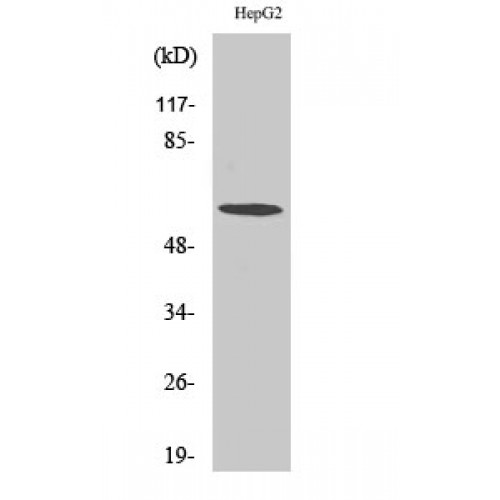 CCT6A Antibody - Western blot of TCP-1 zeta antibody