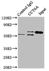 CCT6A Antibody - Immunoprecipitating CCT6A in Hela whole cell lysate Lane 1: Rabbit control IgG instead of CCT6A Antibody in Hela whole cell lysate.For western blotting, a HRP-conjugated Protein G antibody was used as the secondary antibody (1/2000) Lane 2: CCT6A Antibody (8µg) + Hela whole cell lysate (500µg) Lane 3: Hela whole cell lysate (10µg)