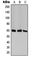 CCT6A Antibody - Western blot analysis of TCP1 zeta expression in H1299 (A); mouse brain (B); PC12 (C) whole cell lysates.