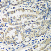 CCT6A Antibody - Immunohistochemistry of paraffin-embedded human stomach tissue.