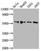 CCT6A Antibody - Western Blot Positive WB detected in: Hela whole cell lysate, HepG2 whole cell lysate, U251 whole cell lysate, 293T whole cell lysate All Lanes: CCT6A antibody at 4.2µg/ml Secondary Goat polyclonal to rabbit IgG at 1/50000 dilution Predicted band size: 59, 54 KDa Observed band size: 59 KDa