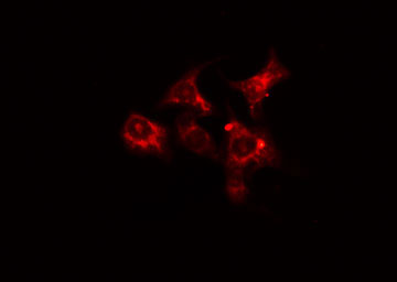 CCT6A Antibody - Staining HepG2 cells by IF/ICC. The samples were fixed with PFA and permeabilized in 0.1% Triton X-100, then blocked in 10% serum for 45 min at 25°C. The primary antibody was diluted at 1:200 and incubated with the sample for 1 hour at 37°C. An Alexa Fluor 594 conjugated goat anti-rabbit IgG (H+L) antibody, diluted at 1/600, was used as secondary antibody.