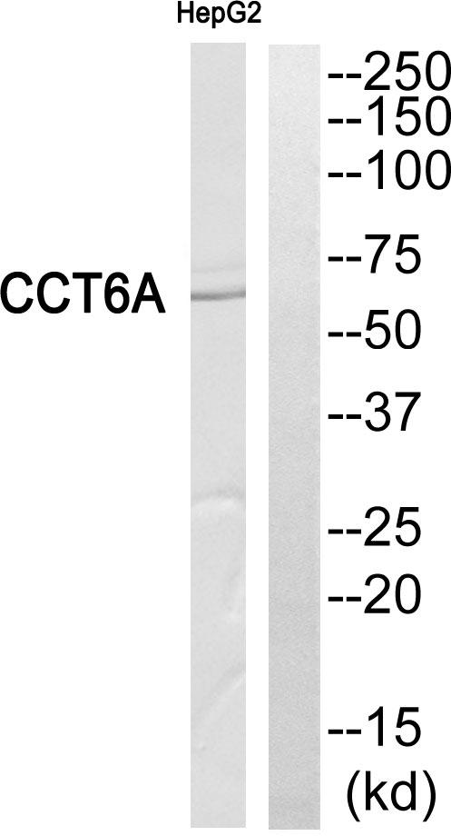 CCT6A Antibody - Western blot analysis of extracts from HepG2 cells, using CCT6A antibody.