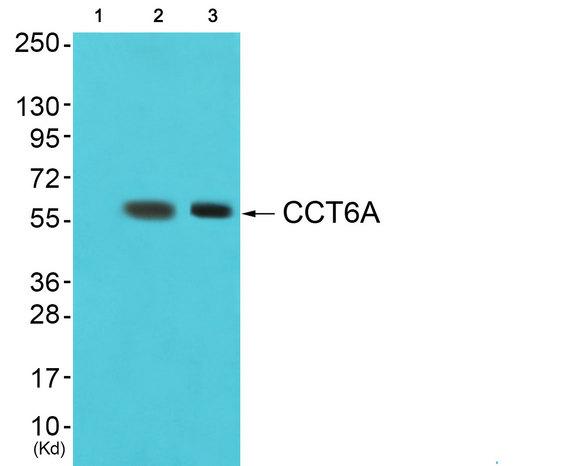 CCT6A Antibody - Western blot analysis of extracts from COS7 cells and 293 cells, using CCT6A antibody.
