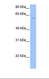 CCT6B Antibody - 721_B cell lysate. Antibody concentration: 1.0 ug/ml. Gel concentration: 12%.  This image was taken for the unconjugated form of this product. Other forms have not been tested.