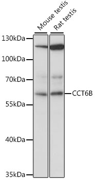 CCT6B Antibody - Western blot analysis of extracts of various cell lines, using CCT6B antibody at 1:1000 dilution. The secondary antibody used was an HRP Goat Anti-Rabbit IgG (H+L) at 1:10000 dilution. Lysates were loaded 25ug per lane and 3% nonfat dry milk in TBST was used for blocking. An ECL Kit was used for detection and the exposure time was 15s.