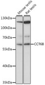 CCT6B Antibody - Western blot analysis of extracts of various cell lines, using CCT6B antibody at 1:1000 dilution. The secondary antibody used was an HRP Goat Anti-Rabbit IgG (H+L) at 1:10000 dilution. Lysates were loaded 25ug per lane and 3% nonfat dry milk in TBST was used for blocking. An ECL Kit was used for detection and the exposure time was 15s.