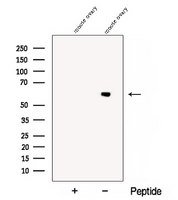 CCT6B Antibody - Western blot analysis of extracts of mouse ovary tissue using CCT6B antibody. The lane on the left was treated with blocking peptide.