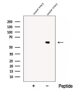 CCT6B Antibody - Western blot analysis of extracts of mouse ovary tissue using CCT6B antibody. The lane on the left was treated with blocking peptide.