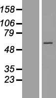 CCT6B Protein - Western validation with an anti-DDK antibody * L: Control HEK293 lysate R: Over-expression lysate