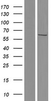 CCT6B Protein - Western validation with an anti-DDK antibody * L: Control HEK293 lysate R: Over-expression lysate