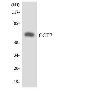 CCT7 Antibody - Western blot analysis of the lysates from HT-29 cells using CCT7 antibody.