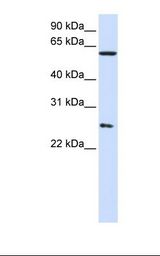 CCT7 Antibody - 293T cell lysate. Antibody concentration: 1.0 ug/ml. Gel concentration: 12%.  This image was taken for the unconjugated form of this product. Other forms have not been tested.
