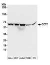 CCT7 Antibody - Detection of human and mouse CCT7 by western blot. Samples: Whole cell lysate (50 µg) from HeLa, HEK293T, Jurkat, mouse TCMK-1, and mouse NIH 3T3 cells prepared using NETN lysis buffer. Antibodies: Affinity purified rabbit anti-CCT7 antibody used for WB at 0.1 µg/ml. Detection: Chemiluminescence with an exposure time of 3 seconds.