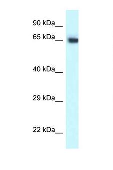 CCT7 Antibody - CCT7 antibody Western blot of Mouse Pancreas lysate. Antibody concentration 1 ug/ml.  This image was taken for the unconjugated form of this product. Other forms have not been tested.