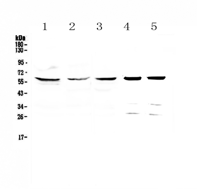 CCT7 Antibody - Western blot - Anti-TCP1 eta Picoband antibody