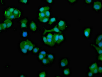 CCT7 Antibody - Immunofluorescence staining of MCF-7 cells at a dilution of 1:100, counter-stained with DAPI. The cells were fixed in 4% formaldehyde, permeabilized using 0.2% Triton X-100 and blocked in 10% normal Goat Serum. The cells were then incubated with the antibody overnight at 4 °C.The secondary antibody was Alexa Fluor 488-congugated AffiniPure Goat Anti-Rabbit IgG (H+L) .
