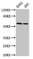 CCT7 Antibody - Positive Western Blot detected in K562 whole cell lysate, 293 whole cell lysate. All lanes: CCT7 antibody at 3 µg/ml Secondary Goat polyclonal to rabbit IgG at 1/50000 dilution. Predicted band size: 60, 38, 55, 51 KDa. Observed band size: 60 KDa