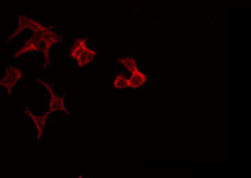 CCT7 Antibody - Staining HeLa cells by IF/ICC. The samples were fixed with PFA and permeabilized in 0.1% Triton X-100, then blocked in 10% serum for 45 min at 25°C. The primary antibody was diluted at 1:200 and incubated with the sample for 1 hour at 37°C. An Alexa Fluor 594 conjugated goat anti-rabbit IgG (H+L) Ab, diluted at 1/600, was used as the secondary antibody.