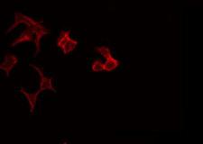 CCT7 Antibody - Staining HeLa cells by IF/ICC. The samples were fixed with PFA and permeabilized in 0.1% Triton X-100, then blocked in 10% serum for 45 min at 25°C. The primary antibody was diluted at 1:200 and incubated with the sample for 1 hour at 37°C. An Alexa Fluor 594 conjugated goat anti-rabbit IgG (H+L) Ab, diluted at 1/600, was used as the secondary antibody.