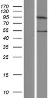 CCT7 Protein - Western validation with an anti-DDK antibody * L: Control HEK293 lysate R: Over-expression lysate