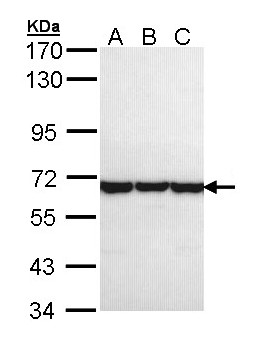 CCT8 Antibody - Sample (30 ug of whole cell lysate). A: A431 , B: H1299, C: Hela. 7.5% SDS PAGE. CCT8 antibody diluted at 1:1000.