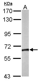 CCT8 Antibody - Sample (50 ug of whole cell lysate). A: Mouse brain. 7.5% SDS PAGE. CCT8 antibody diluted at 1:5000.