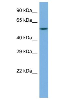 CCT8 Antibody - CCT8 antibody Western Blot of HT1080. Antibody dilution: 1 ug/ml.  This image was taken for the unconjugated form of this product. Other forms have not been tested.