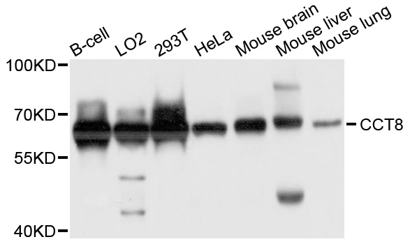 CCT8 Antibody - Western blot analysis of extract of various cells.