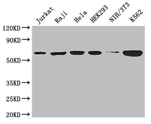 CCT8 Antibody - Positive WB detected in:Jurkat whole cell lysate,Raji whole cell lysate,Hela whole cell lysate,HEK293 whole cell lysate,NIH/3T3 whole cell lysate,K562 whole cell lysate;All lanes: CCT8 antibody at 3ug/ml;Secondary;Goat polyclonal to rabbit IgG at 1/50000 dilution;Predicted band size: 60,58,52 kDa;Observed band size: 60 kDa;